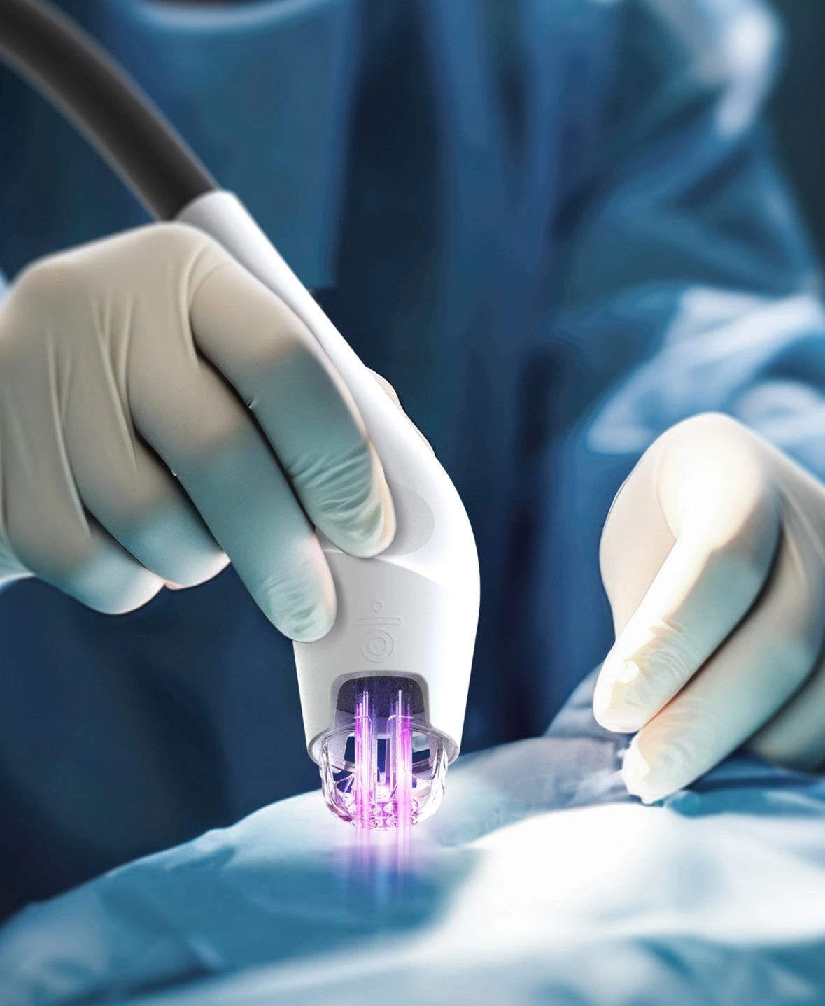 Plasma froid